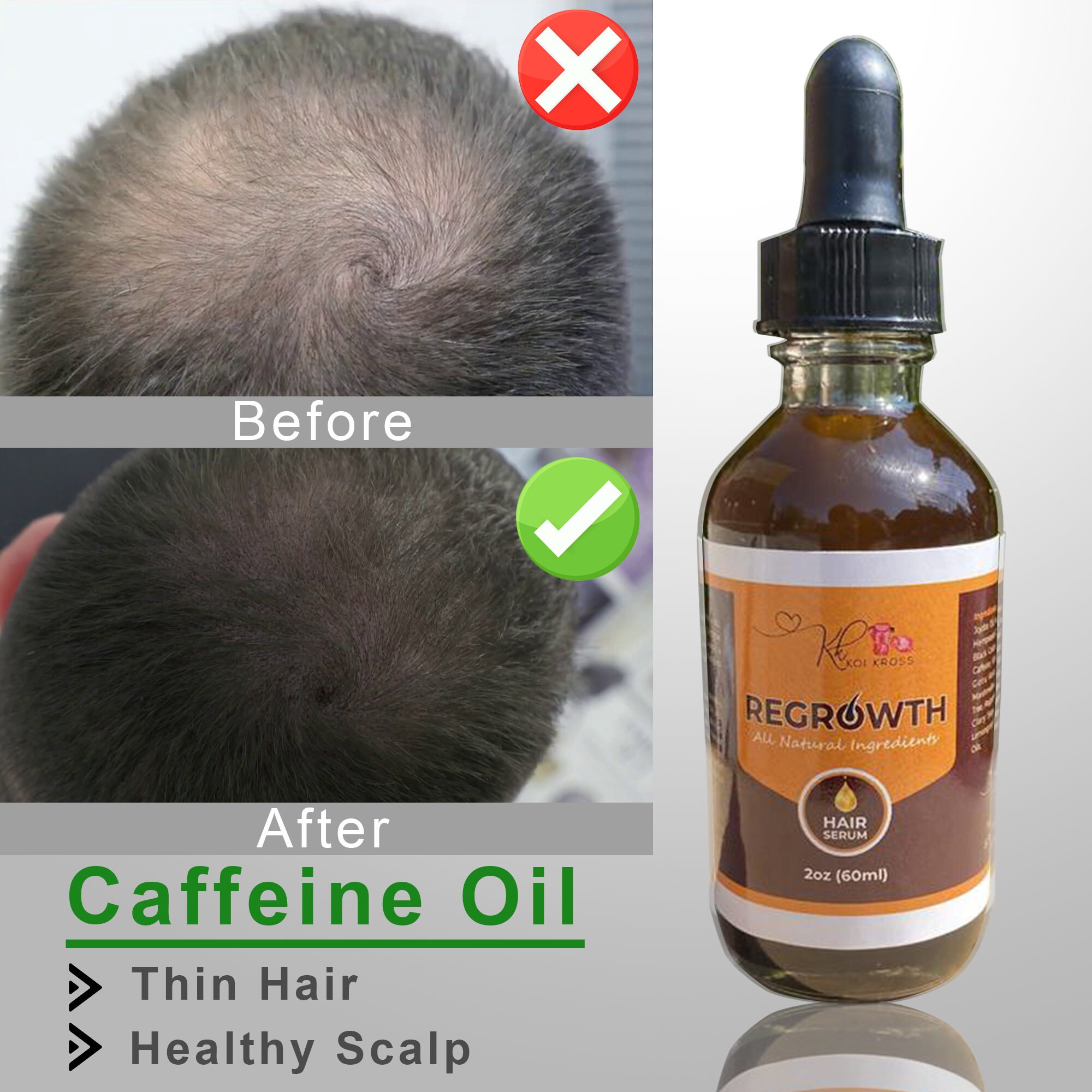 Best Hair Regrowth Serum for Thinning Hair Healthy Scalp Etsy