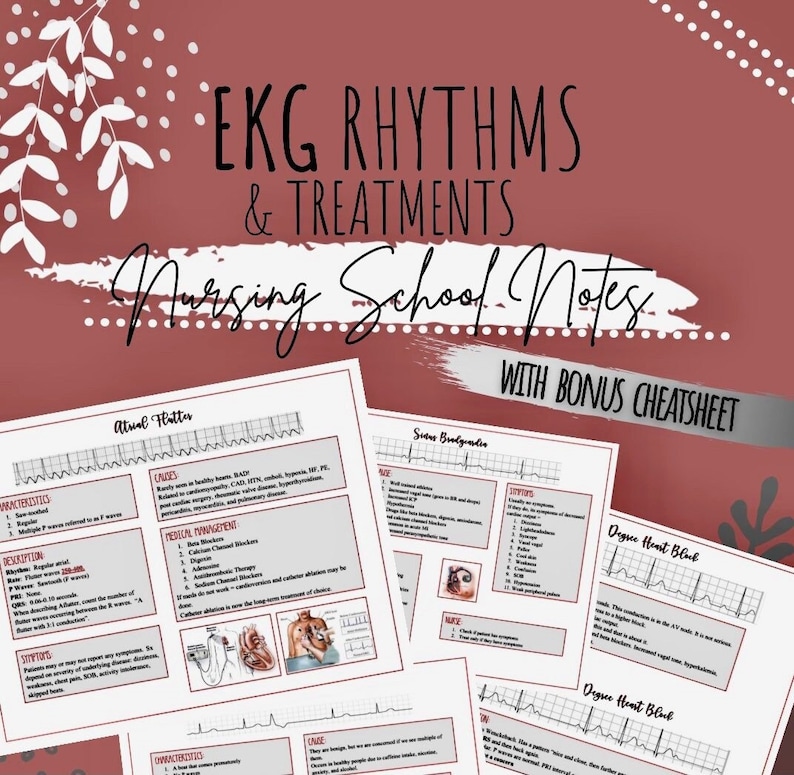 EKG Rhythms Nursing Bundle - Cheat Sheets - Etsy