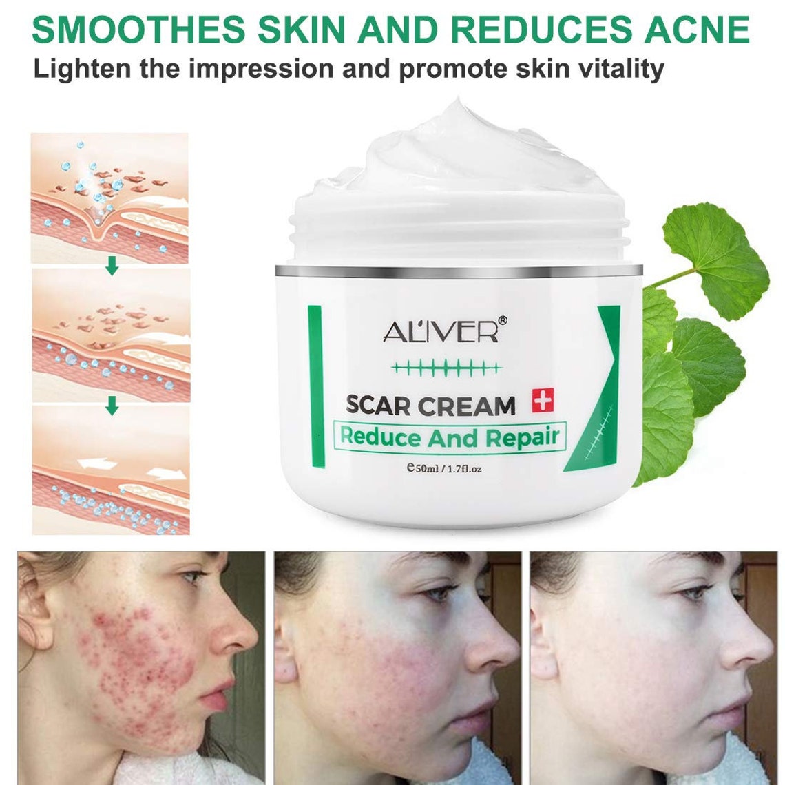 Scar Removal GelRemoval Ointment GelScar Removal Cream Skin Etsy