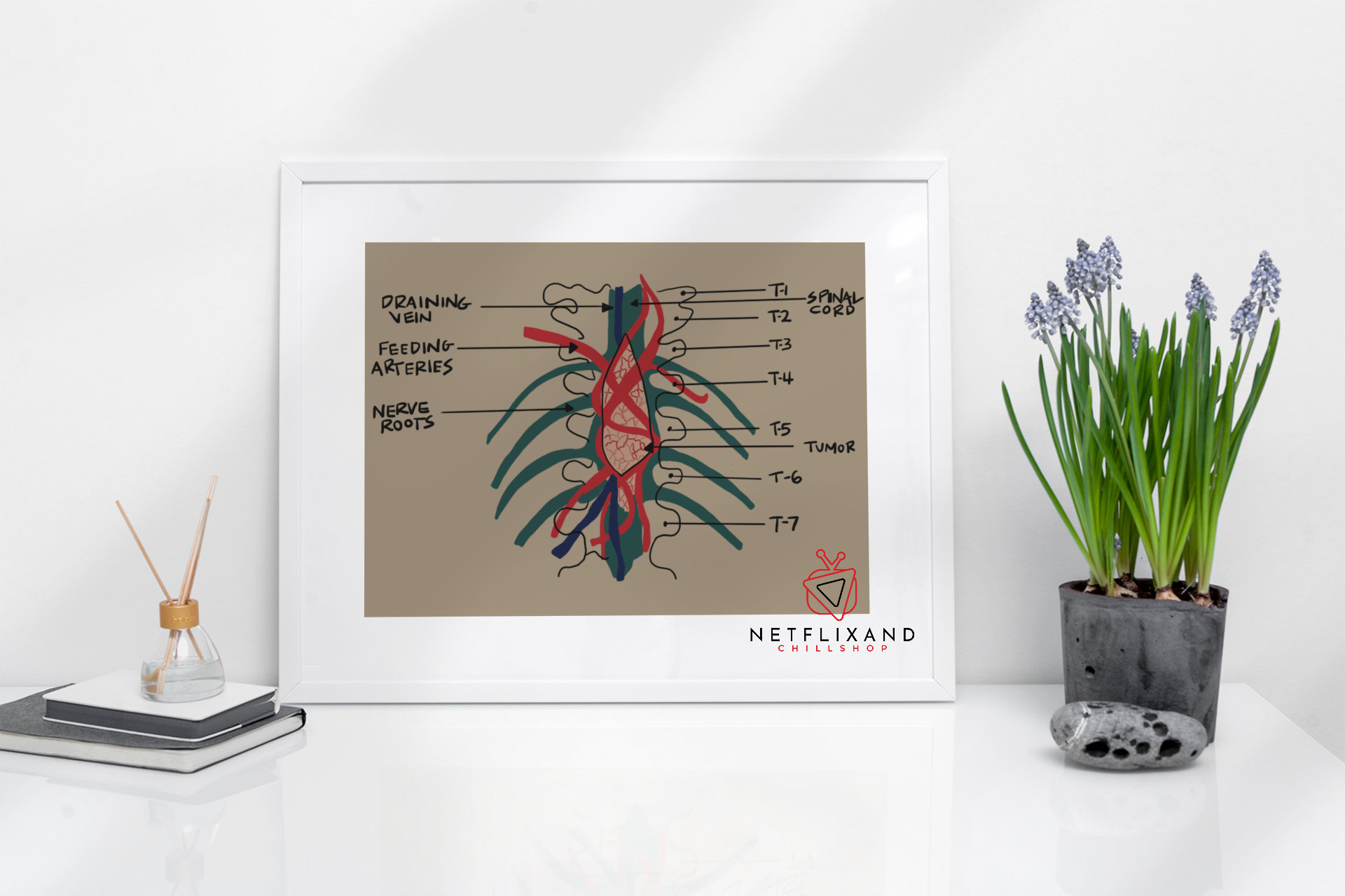 Greys Anatomy Tumor Print - Derek Shepherd, TV Show Print