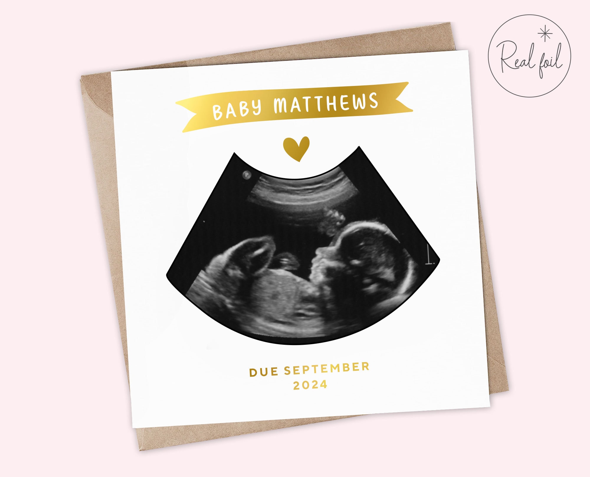 Pregnancy Announcement Card, Baby Announcement Card, Uncle, Auntie, Grandparent Card Baby, Baby Scan Photo, We've Something to Tell You - Etsy