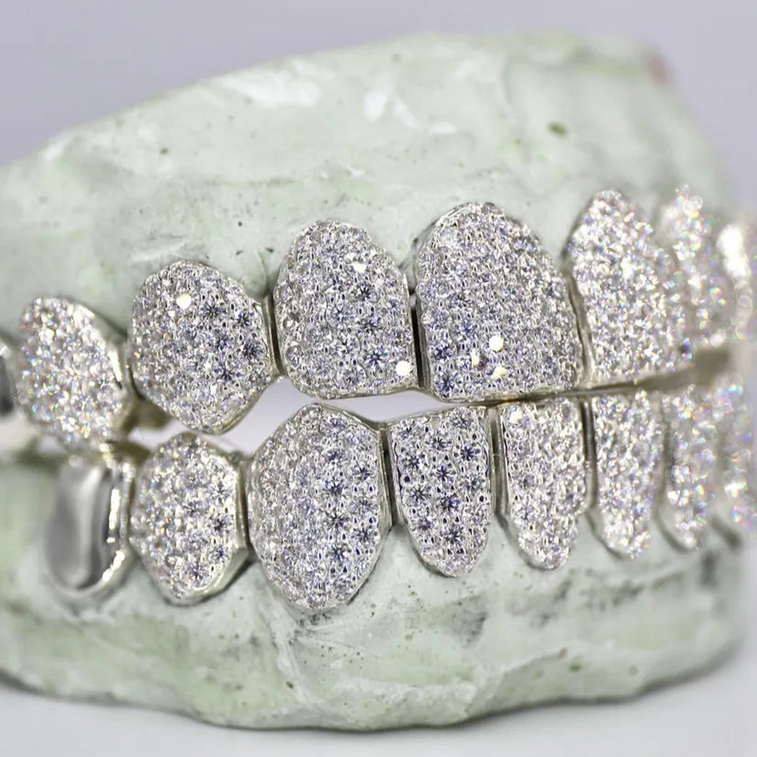 10 on 10 VVS Moissanite Diamond Grillz,top and Bottom Grillz Set,icy
