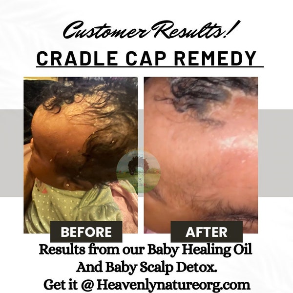 Cradle Cap Etsy