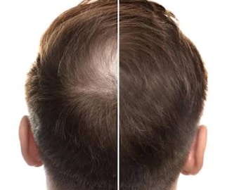 Olio biologico per la crescita dei capelli Sudanese Karkar كركار زيت شعر سوداني