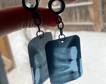 Vintage Dental X-Ray Gauges - Oddity Earrings - Ear weights - Antique Dentistry - Teeth Earrings - Oddities and Curiosities - Medical Gifts