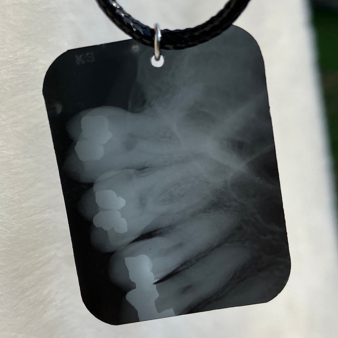 Dental X-ray Necklace Pendant - Etsy