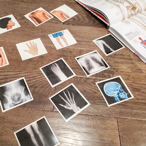 Könnte beinhalten: Ein Satz von 12 Karten mit verschiedenen anatomischen Bildern, darunter ein Skelett, ein Schädel, eine Hand, ein Fuß und eine Röntgenaufnahme des Beckens. Die Karten sind auf weißem Karton gedruckt und in einem Rastermuster auf einer Holzoberfläche angeordnet.