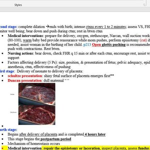 Maternal-Newborn ATI key notes 40 pages
