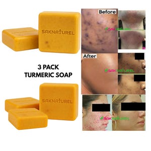 3 pack ORGANIC TURMERIC Honey Soap 100% Natural Organic, Raw Turmeric and Papaya Powder, Turmeric Soap, Gentle Bar For Face And Body