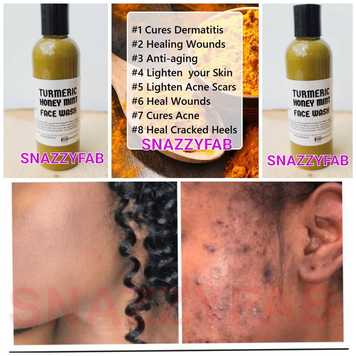Turmeric Face wash face wash Turmeric cleanser Acne wash Etsy