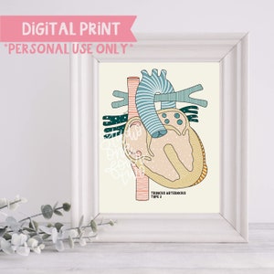 Truncus Arteriosus Type 2 Digital Print | Anatomical Heart Illustration | Digital Print Only | CHD Illustrations
