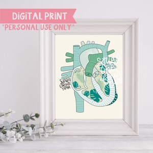 Supracardiac TAPVR Digital Print | Anatomical Heart Illustration | Digital Print Only | CHD Illustrations
