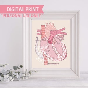 Scimitar Syndrome Digital Print | Anatomical Heart Illustration | Digital Print Only | CHD Illustrations