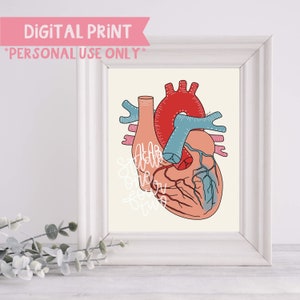 ALCAPA Digital Print | Anatomical Heart Illustration | Digital Print Only | CHD Illustrations
