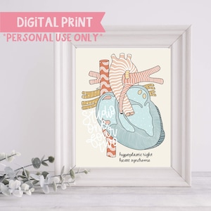 HRHS Digital Print | Anatomical Heart Illustration | Digital Print Only | CHD Illustrations