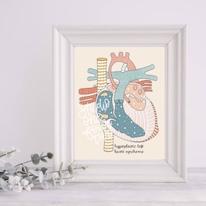 HLHS Art Print | Surgery Series Art Prints | Physical Print | CHD Illustration Print