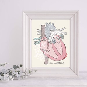 ASD Art Print | CHD Art Print | Physical Print | Heart Defect Illustration Print