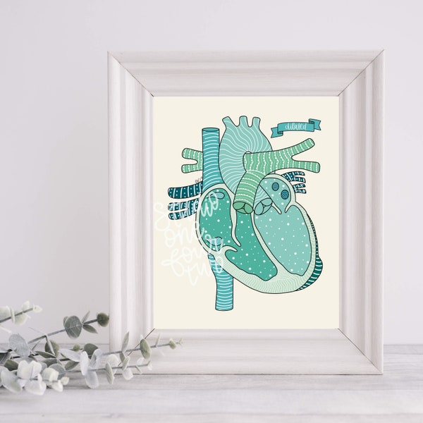 Dilated Cardiomyopathy Art Print | Physical Print | CHD Heart Illustration Print