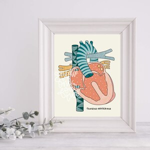 Truncus Arteriosus Art Print | CHD Art Print | Physical Print | Heart Defect Illustration Print