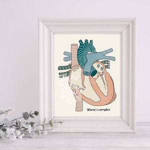 Shone’s Complex Art Print | CHD Art Print | Physical Print | Heart Defect Illustration Print