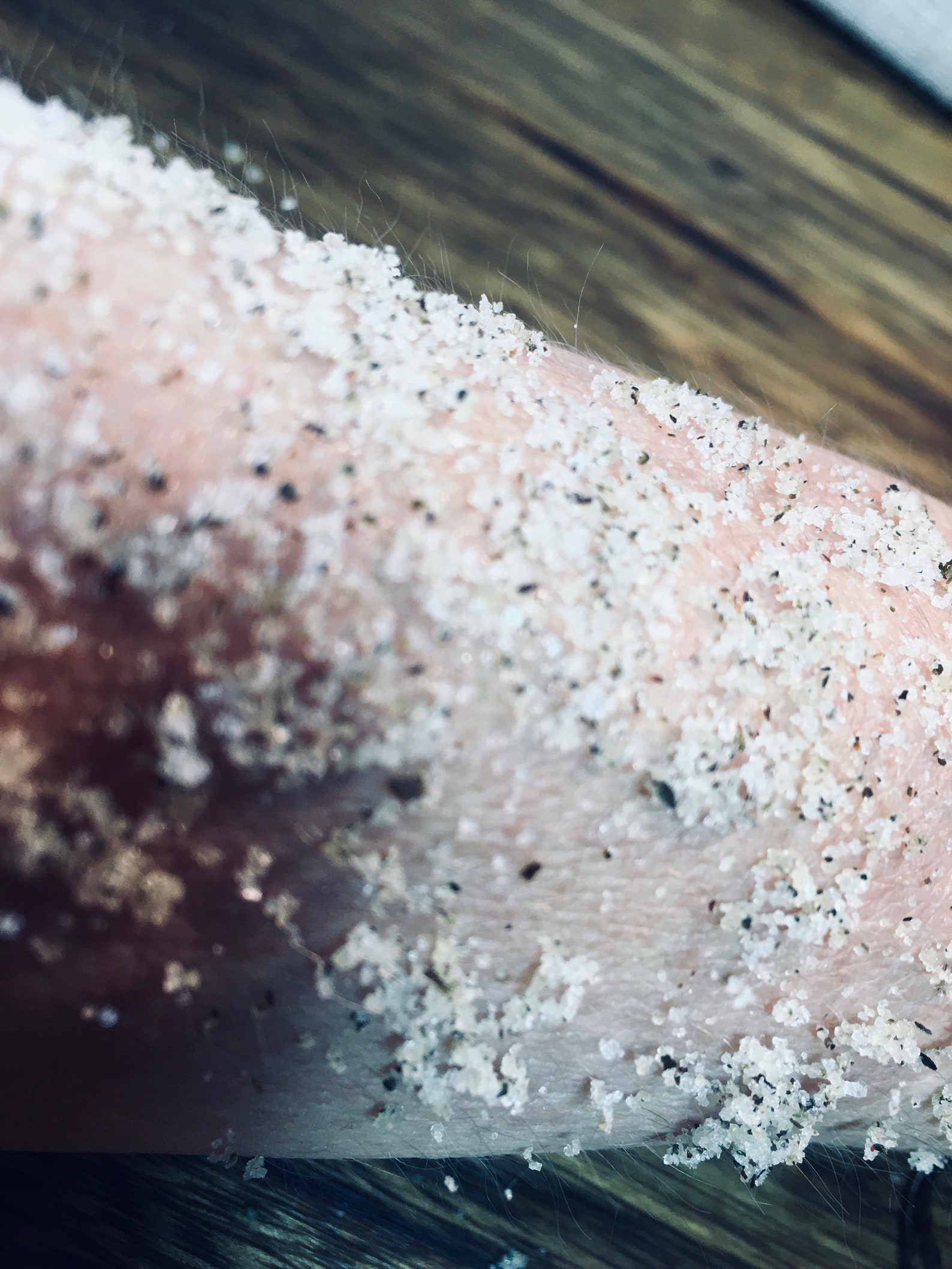 Acne Pimples PizzaFace 2 phase treatment. Curative anti Etsy