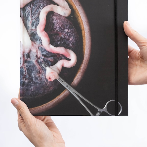 Notebook | Placenta with clamp |