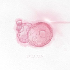 Custom IVF Embryo Watercolor Painting