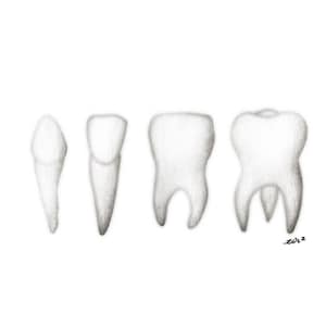 Adesivos dentários para dentes