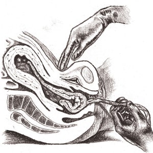 Five Piece Uterine Anatomy Illustration Set