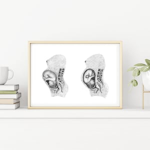 Posterior and Anterior Fetal Presentations: Birth/Doula/Midwife Art Printable