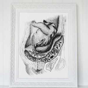 Placenta Previa: Birth/Doula/Midwife Art Printable