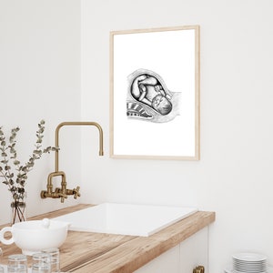 Shoulder Dystocia: Birth/Doula Art Printable