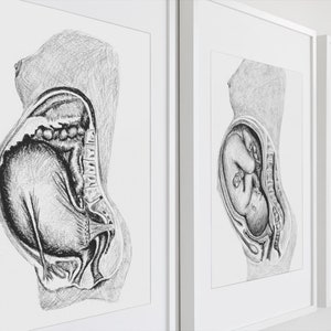 Uterine Ligaments: Birth/Doula Art Printable