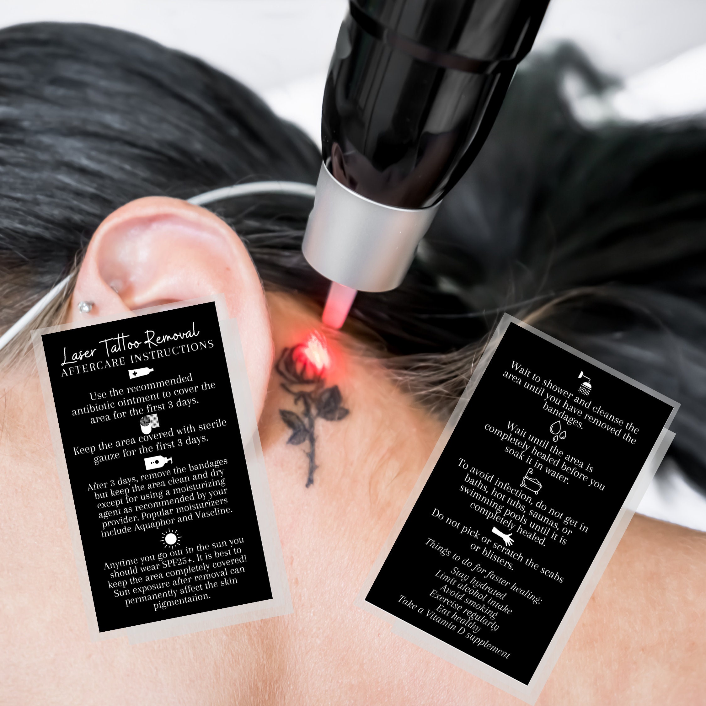 Laser Tattoo Removal Aftercare Instruction Cards Digital Etsy