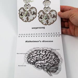 Brain Anatomy Flip Charts pages