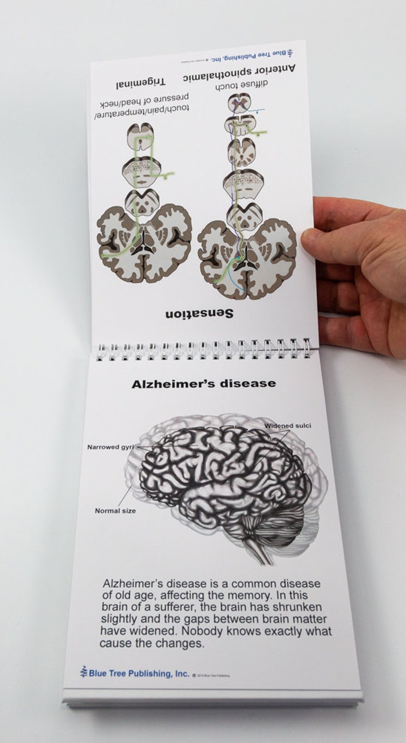 Brain Anatomy Flip Charts pages