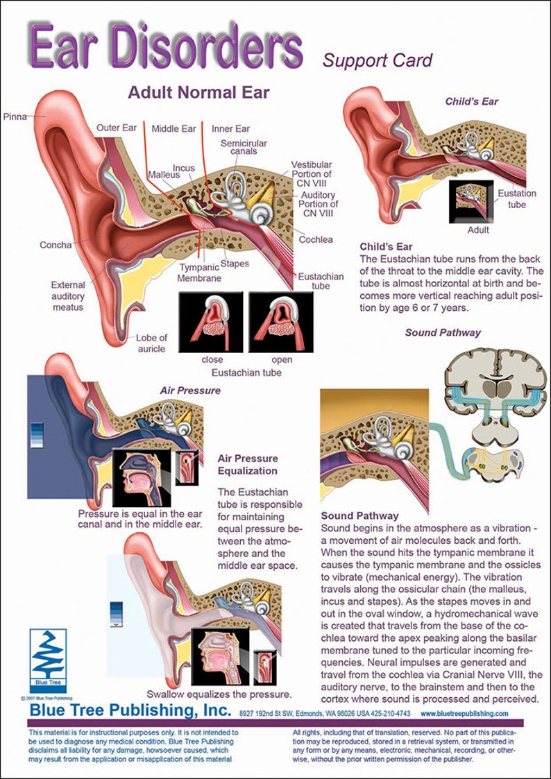 Ear Disorders Anatomical Charts - Etsy