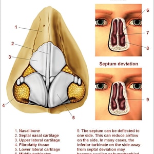 Nose and Sinuses Anatomical Chart