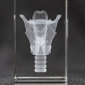 May include: A clear glass cube with a 3D laser-etched image of a human tooth implant. The implant is shown in detail, including the screw threads and the crown.