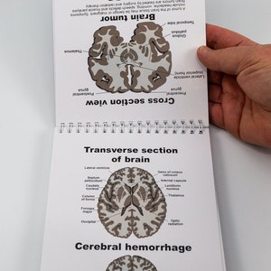 Brain Anatomy Flip Charts pages
