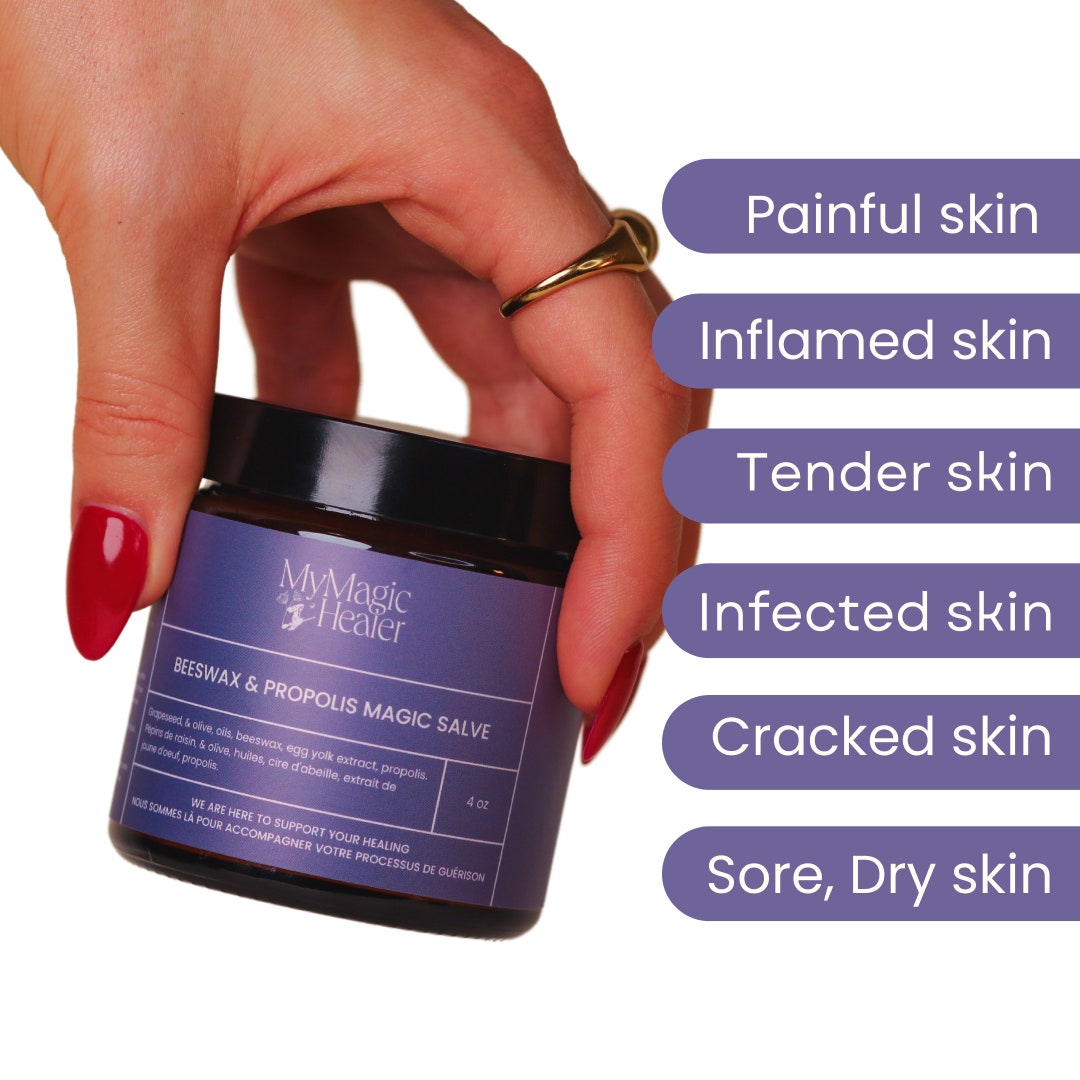 Beeswax & Propolis Magic Salve Multi Purpose Salve Etsy