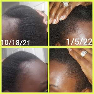 Hair Growth Oil, Ayurvedic herbs, hair growth, shedding/balding