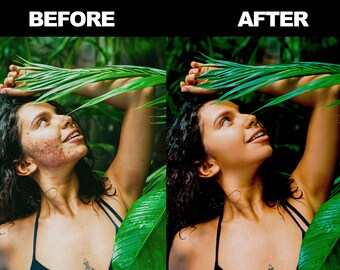 Photo Retouch/Photo Professional Skin Retouching/Removing Acne From Photo/Image Retouching/Photo Editing/Image Retouch/Blemish Remover