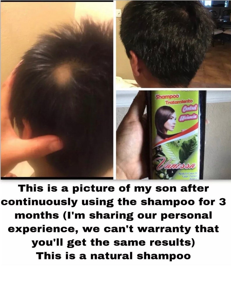 Copalquin Hair Growth Shampoo, 100% Natural image 2