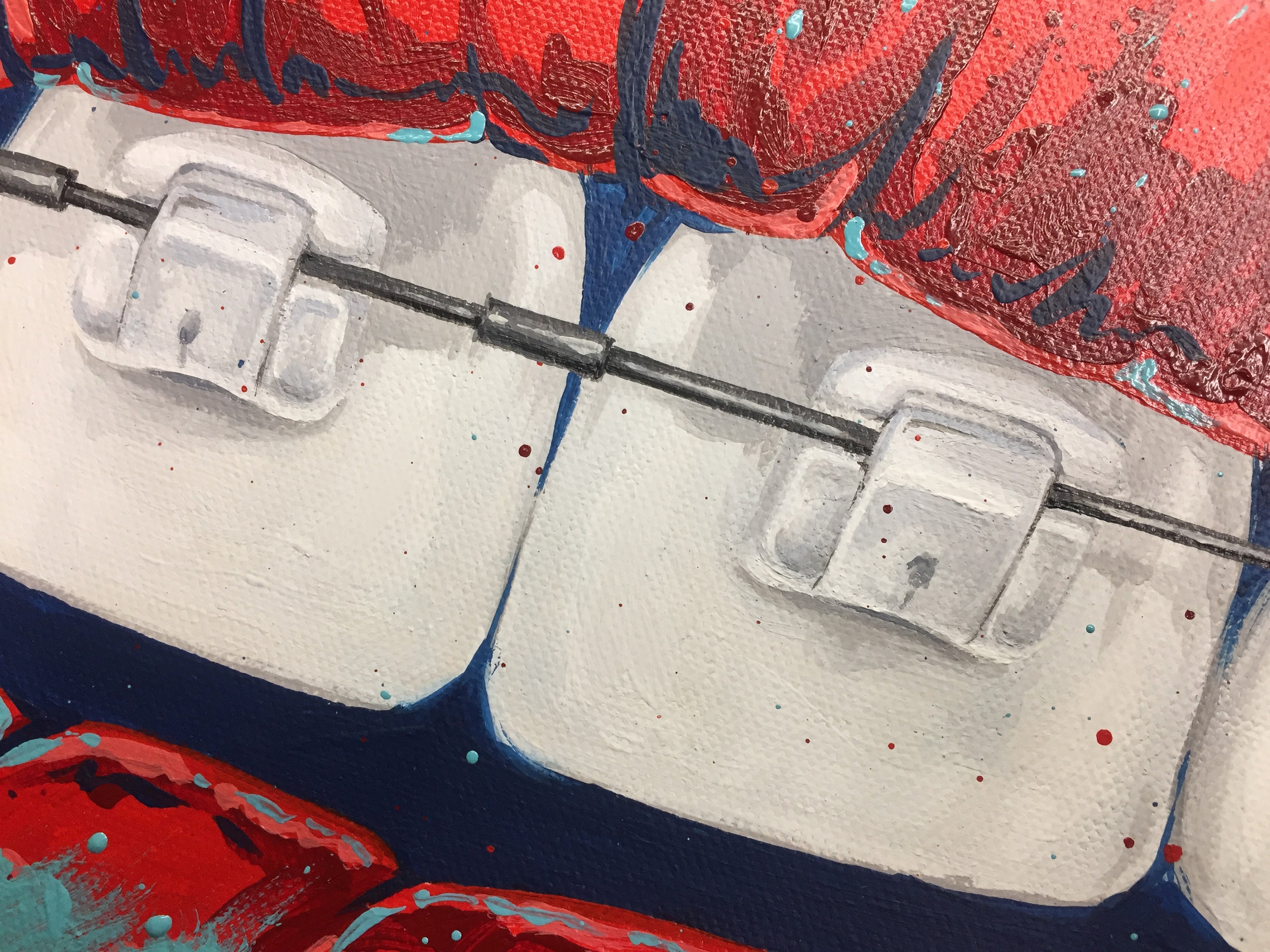 Dental painting teeth with braces Lips and teeth Etsy