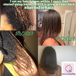 Home Remedies for Natural Hair Regrowth using Chebe Oil. Best for Female and Male Hair Loss4 Piece Hair Growth Set|Healing|Restore|HealthyHair|AloeVeraFenugreekHairSpray|ThickHairOil|AlopeciaTreatment|HairLossBaldingThinHair|Chebe