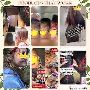 4pc MEGA REGROWTH SET|ThickHairOil HairLoss FenugreekAloeVeraRosemaryHairSpray|AlopeciaNatural|BaldingThinHair|DryItchyScalp|Edges|Locs|16oz