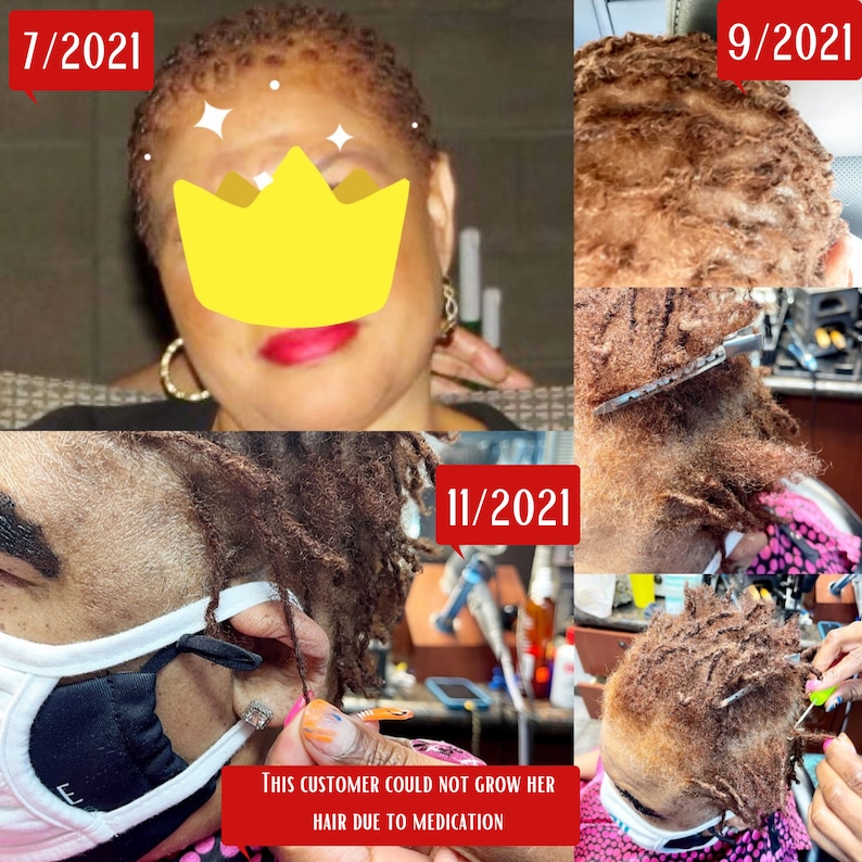 Home Remedies for Natural Hair Regrowth using Chebe Oil. Best for Female and Male Hair Loss4 Piece Hair Growth Set|Healing|Restore|HealthyHair|AloeVeraFenugreekHairSpray|ThickHairOil|AlopeciaTreatment|HairLossBaldingThinHair|Chebe