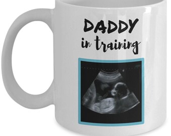 Custom Sonogram Picture Mug For New Dad - Custom Mug For New Father - Custom Sonogram Picture Mug - 11oz Coffee Mug - 15oz Coffee Mug