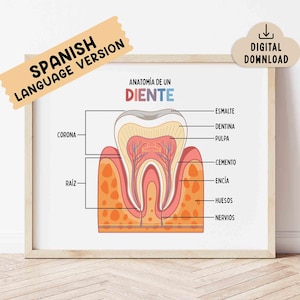 May include: A framed print depicting a tooth's anatomy, with labels in Spanish. The diagram details the crown, root, enamel, dentine, pulp, cementum, gum, bone, and nerves. A banner reads "Spanish Language Version" and a cloud icon says "Digital Download".